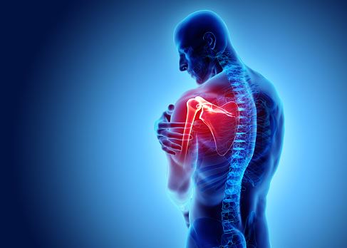 arthritis pain